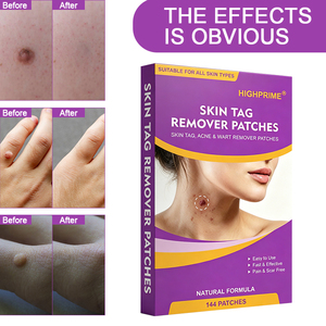 Hot Sale Highprime <strong>Skin</strong> <strong>Tag</strong> <strong>Remover</strong> <strong>Patches</strong> for <strong>Skin</strong> <strong>Tag</strong> Wart Acne - Product Image 5