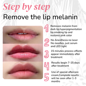 Sérum éclaircissant pour les lèvres avancé, cible la mélanine pour réduire efficacement les taches sombres, unifie le teint des lèvres roses - Product Image 3