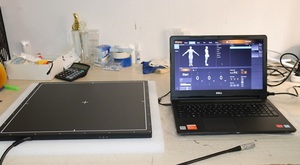 Equipo Médico, Detector de Panel Plano Digital Inalámbrico Portátil de Rayos X de 17''*17'' para Máquina de Rayos X - Product Image 3
