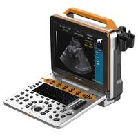 Escáner de ultrasonido portátil veterinario Dawei Sistema Doppler de color digital sonoscape ultrasonido p60