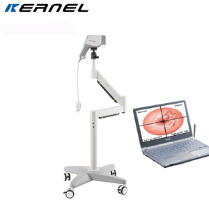 1080P Kernel Kn-2200 Hd Draagbare Digitale Video <span class=keywords><strong>Vagina</strong></span> Colposcoop Voor Onderzoek Van Vaginale Laesies Gynaecologie Onderzoek - Product Image 2
