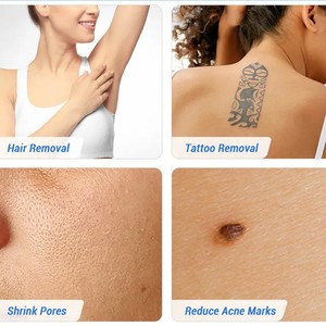 2026 New 2 In1 Blackhead Removal Pore Cleanings Picosecond-lasers-tattoo Removal & Wavelength Diode-lasers-hair-removal Machine - Product Image 4
