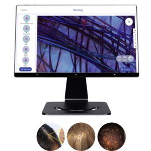 Analyseur de Cheveux et de Cuir Chevelu Portable AI avec Grand Écran – Vente en Gros Usine - Product Image 4