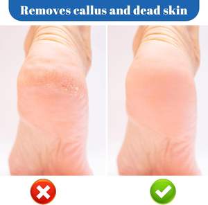 Kit de Soin des Pieds Professionnel en Acier Inoxydable : Râpe à Pieds, Lime à Callosités, Pierre Ponce Double Face pour Éliminer les Peaux Mortes - En Stock - Product Image 3