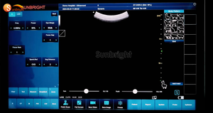 SUN-D7 Peut Utiliser à la Fois le WIFI et le USB Sonde d'Échographie Vétérinaire Sans Fil à Double Tête Mini Machine d'Échographie Sans Fil - Product Image 3
