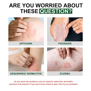 Pommade topique de haute qualité à vente chaude Soulage l'urticaire Anti-problèmes Soins quotidiens de la peau - Product Image 4