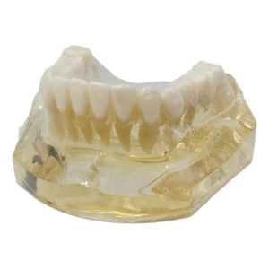 علوم طبية دراسة طبيب الأسنان موارد تعليمية إلكترونية محاكاة عالية الجودة راتنج زرع الأسنان الفك السفلي - Product Image 3