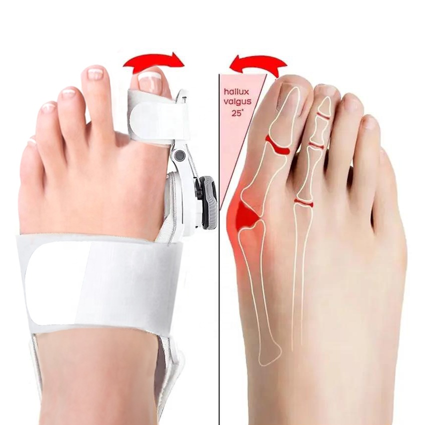 Разделитель для пальцев ног Растяжка при вальгусной деформации ортопедические регулируемые подтяжки выпрямитель для большого пальца ног противомозолевой корректор HA00799