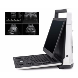 Escáner de Ultrasonido Veterinario <span class=keywords><strong>Sonoscape</strong></span> E1v <span class=keywords><strong>Vet</strong></span> 3D 2D Blanco y Negro Portátil Veterinario Ultrasonido BW - Product Image 3