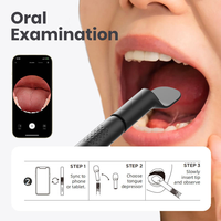 Kit de contrôle visuel intelligent pour la santé des oreilles, de la bouche et du nez, accessoire ORL, caméra pour le nettoyage des cérumen, appareil portable pour usage domestique, fournitures de nettoyage