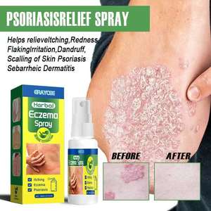 Spray Erboristico Biologico per Eczema, Psoriasi e Dermatite, Lenitivo ad Azione Rapida, Anti-Infiammatorio, Spray per la Cura della Pelle 30ml - Product Image 1