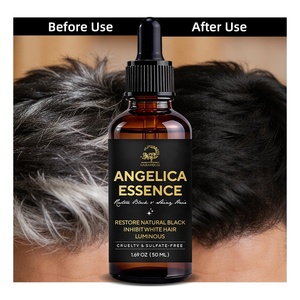Tratamiento OEM ODM para el Cabello Gris para Hombres y Mujeres, Tratamiento para Cabello Canoso, Tratamiento para Convertir el Cabello Gris en Negro, Suero <span class=keywords><strong>Angelica</strong></span> Anti-Canas - Product Image 2