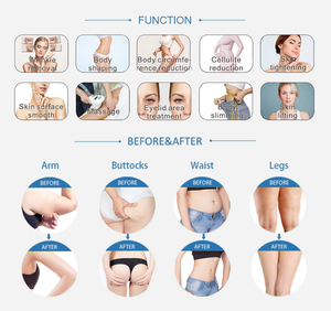 Appareil de massage amincissant Vela Body Shape pour brûler les graisses, lutter contre la cellulite et les rides, avec rouleau à vide - Product Image 2
