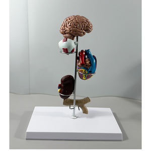 Modelos Anatómicos Médicos de Patología de la Presión Arterial Alta de Maxcare (Cerebro/Ojos/Corazón/Riñones/Vasos Sanguíneos/Organos Internos) de PVC - Product Image 4