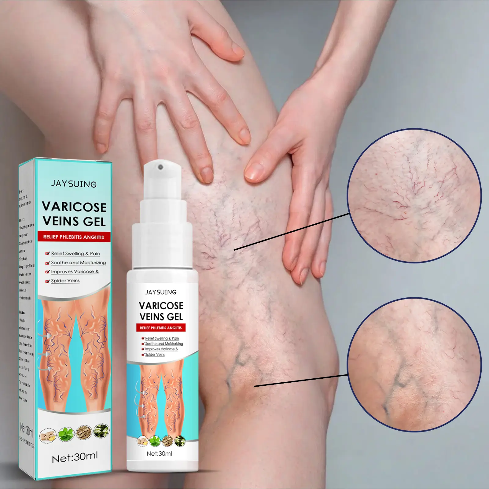 Pommade à base de plantes soulager les soins phlébite angéite dissolvant de varices gel crème, araignée varices traitement gel crème