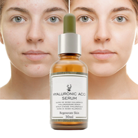 Sérum Visage Liquide OEM Végétalien Bio aux Herbes, Éclaircissant, au Collagène, Niacinamide, Vitamine C, Glycérine et Acide Hyaluronique pour