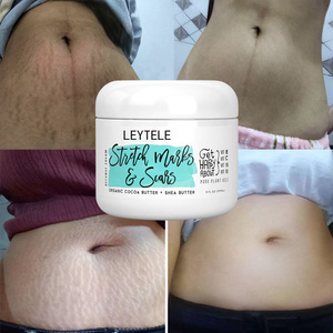 Crema Reparadora de Estrías de Marca Privada para el Cuidado de la Piel, Eliminación de Cicatrices del Embarazo, Crema Natural de Manteca de Karité para el Abdomen - Product Image 1