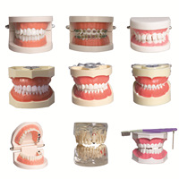 DM Dental Tooth Gems modelo educativo médico-paciente caries modelo de exhibición dentista enseñanza estudio