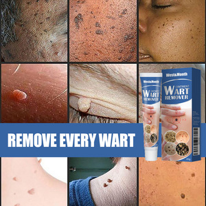 West Month OEM Warts <strong>Remover</strong> Ointment Skin Tags Gel Point Beauty <strong>Mole</strong> <strong>Removal</strong> <strong>Cream</strong> - Product Image 2