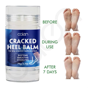 Bálsamo Reparador para Talones Agrietados de Marca Privada, Exfoliante, Hidratante y Humectante, Tratamiento para Pies Secos - Product Image 2