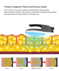 Appareil de beauté CoolPulse pour l'amincissement et la réduction de la graisse abdominale, pour la construction musculaire abdominale, utilisation à domicile - Product Image 4
