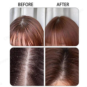 Shampooing exfoliant pour le cuir chevelu, traitement du cuir chevelu 2-en-1 à l'huile de menthe, traitement capillaire pour clarifier et éliminer les accumulations - Product Image 3