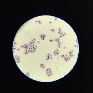 40-1600 배 더블 레이어 모바일 플랫폼과 C-104 LCD 강사 현미경 생물학 실험실 현미경 - Product Image 4