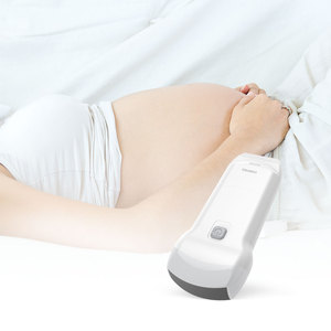 コンテック CMS1600A 超音波ハンドヘルド装置 超音波カラードップラー診断装置 超音波スキャナー 超音波診断装置 - Product Image 3