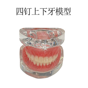 Modèle d'implant dentaire maxillaire et mandibulaire à 2 ou 4 vis en silicone médical pour la formation dentaire - Product Image 4
