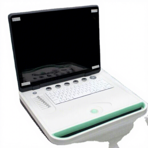 Máquina <span class=keywords><strong>de</strong></span> ultrasonido portátil, <span class=keywords><strong>precio</strong></span> <span class=keywords><strong>de</strong></span> máquina <span class=keywords><strong>de</strong></span> cardiografía <span class=keywords><strong>de</strong></span> Echo médico - Product Image 1