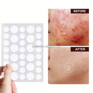 Factory Private Label Heart Star Salicylic Acid Acne Patch Invisible Moisturizer for Skin Care Pore Cleansing Organic Herbal - Product Image 2