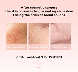 D-nutrimec Rejuvenating Glow Lifting Straffende feuchtigkeit spendende aufhellende rekombinante Kollagen-<span class=keywords><strong>Anti</strong></span>-Falten-Reparatur maske - Product Image 4