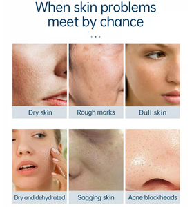 Máquina de Oxígeno 6 en 1 de Última Generación, Hidrodermoabrasión, Hydra Aqua Peel, Máquina Facial, Analizador de Piel - Product Image 5