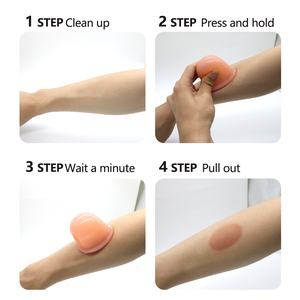 Set Profesional de Masaje de Espalda con Ventosas de Silicona Mini, Ventosas Chinas para Terapia <span class=keywords><strong>Facial</strong></span>, Cuidado de Belleza y Cuidado Personal - Product Image 4