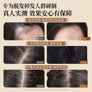 Shampoo anti-chute de cheveux au gingembre Caifeier 500ml, renforce les racines des cheveux, contrôle les pellicules - Product Image 4