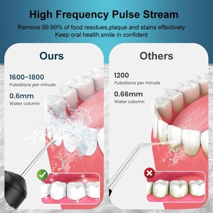 Irrigador Bucal Portátil, Limpiador Dental con Chorro de Agua, Recargable por USB, Irrigador Dental, Chorro de Agua para Limpieza Bucal - Product Image 3
