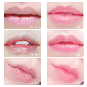 Parches de Hidrogel para Labios de Marca Privada en Oferta, Hidratantes, Humectantes, Voluminizadores, Mascarilla de Noche para Labios con Colágeno Rosa Dorado - Product Image 5