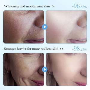 Set <span class=keywords><strong>de</strong></span> Cuidado <span class=keywords><strong>Facial</strong></span> Blanqueador con Ceramidas <span class=keywords><strong>de</strong></span> Marca Privada SADOER, Suero <span class=keywords><strong>Facial</strong></span> Orgánico Hidratante y Nutritivo, <span class=keywords><strong>Kit</strong></span> <span class=keywords><strong>de</strong></span> Cuidado <span class=keywords><strong>de</strong></span> la Piel - Product Image 3