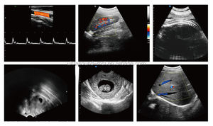 Mesin USG Medis 4D Harga Terjangkau, Mesin USG Diagnostik Doppler Warna dengan Troli, Medsinglong MSLTU04 untuk Rumah Sakit - Product Image 6