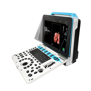 ROBIN RB-P30 Máquina Veterinaria Portátil <span class=keywords><strong>Doppler</strong></span> Color para Laptop con Pantalla LED de 15.6'', Diseño Ecológico, Larga Duración en Espera, Multi-Escena para Granja - Product Image 3