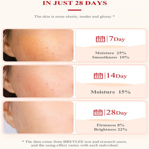 Crema de Día <span class=keywords><strong>Hidratante</strong></span> y Blanqueadora de Granada Roja Breylee, Repara la <span class=keywords><strong>Piel</strong></span> <span class=keywords><strong>Seca</strong></span>, Áspera y de Tono Amarillo Oscuro, la <span class=keywords><strong>Mejor</strong></span> Crema para el Rostro - Product Image 3