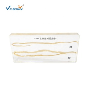 Espécimen de Resina, Espécimen Anatómico de Ascaris Lumbricoides, Espécimen Bioincrustado - Product Image 1