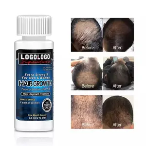 60ml Anti Hair Loss Fast Hair Growth Oil OEM ODM 5% Hair Regrowth Treatment Serum For Women And Men