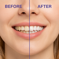 Bandes blanchissantes pour les dents V34, bandes blanchissantes Shine, patchs blanchissants pour éliminer les taches tenaces et protéger l'émail dentaire
