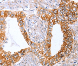 Kháng thể polyclonal <span class=keywords><strong>ABO</strong></span> - Product Image 1
