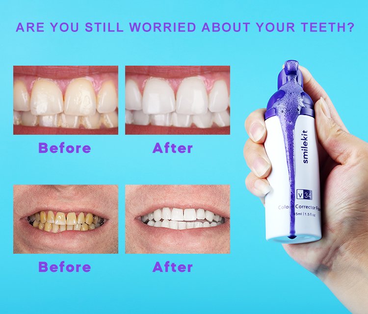 Smilekit® V34 Colour Corrector Foam Toothpaste Purple 🫦 – Smile Kit