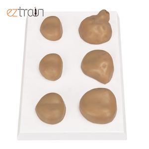 Kelenjar prostat Normal dan sakit, inovasi prostat hiperfikasi, sains medis - Product Image 5