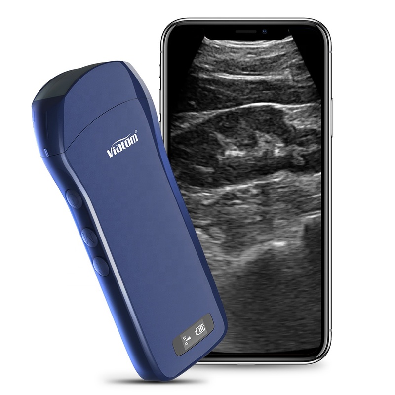 Viatom C10 Wireless Wifi Ultrasound Scanner