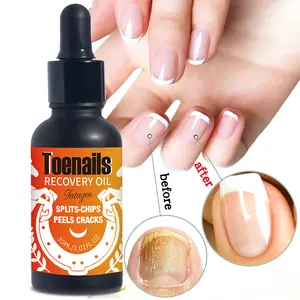 FATAZEN Skincare Products Moisturizing Toenails Recovery Oil 100% Pure Natural Plant Allantion Peels Cracks Recovery Skin Oil