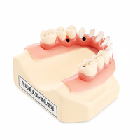 Ecolab Modèle dentaire de restauration de couronne en zircone pour implant dentaire Malo Bridge de qualité médicale, pour la formation et la présentation en soins bucco-dentaires ISO 9001